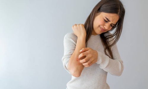 Women scratch the itch with hand , Concept with Healthcare And Medicine. Woman scratching arm on grey background. Allergy symptoms. Woman scratching her arm.